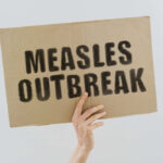 Measles outbreak sign