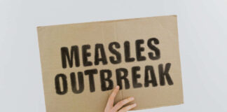 Measles outbreak sign