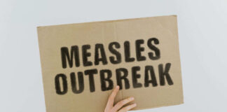Measles outbreak sign