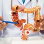 Healthcare professional demonstrating a digestive system model