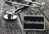 A stethoscope next to a sign reading 'Tuberculosis'