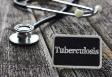 A stethoscope next to a sign reading 'Tuberculosis'