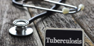 A stethoscope next to a sign reading 'Tuberculosis'