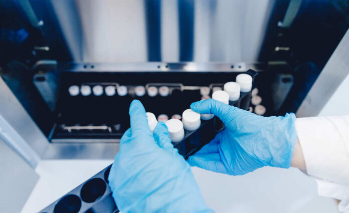 Sperm,Tubes,Are,Placed,In,Bank,To,Store,Genetic,Code, Person in blue gloves handling test tubes in a laboratory